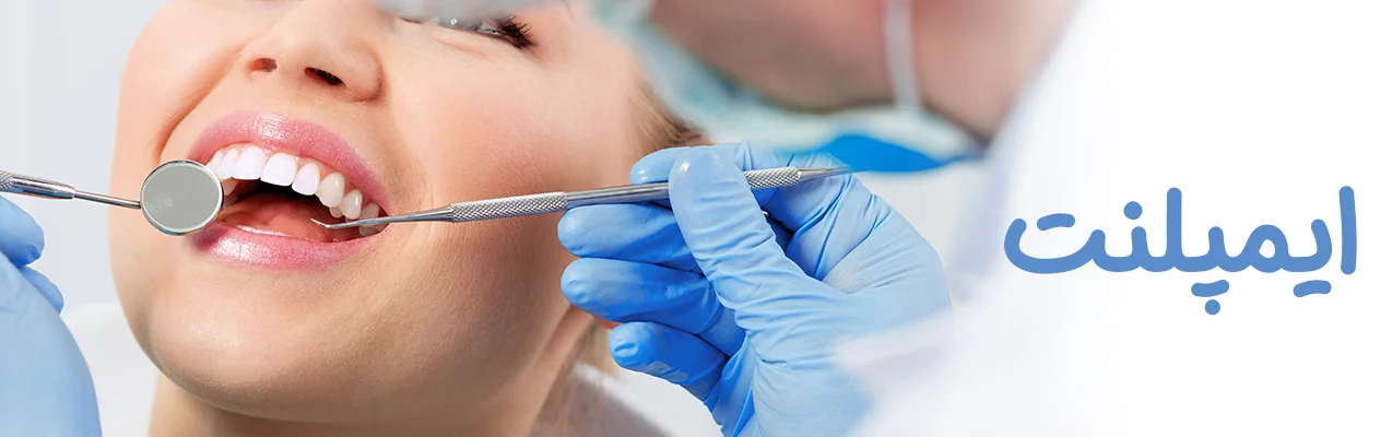 ایمپلنت - کلینیک دندانپزشکی دکتر شهاب محمدی